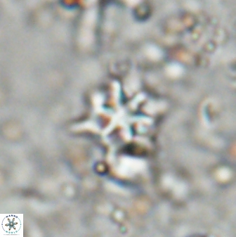 Discoaster artatus 27281
