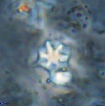 Discoaster artatus 27282