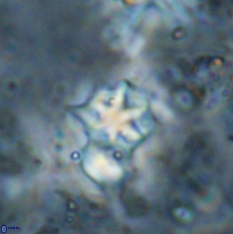 Discoaster artatus 27283