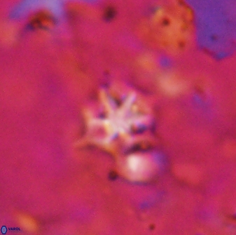 Discoaster artatus 27284