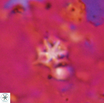 Discoaster artatus 27284