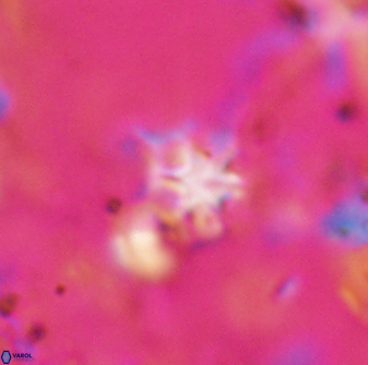 Discoaster artatus 27288