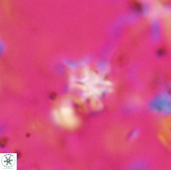 Discoaster artatus 27288