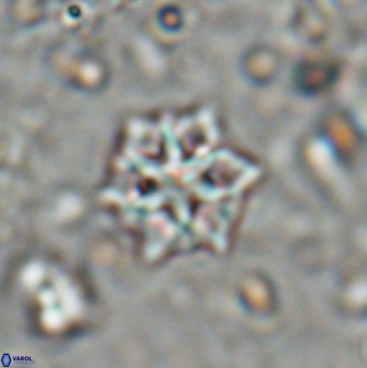 Discoaster artatus 27292