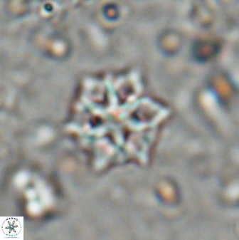 Discoaster artatus 27292