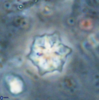 Discoaster artatus 27293