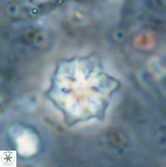 Discoaster artatus 27293