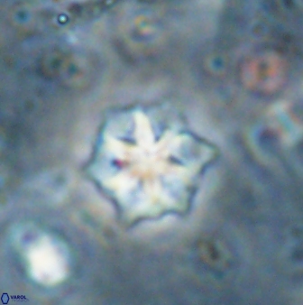 Discoaster artatus 27294