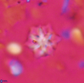 Discoaster artatus 27298