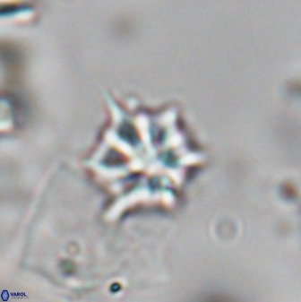 Discoaster artatus 28400