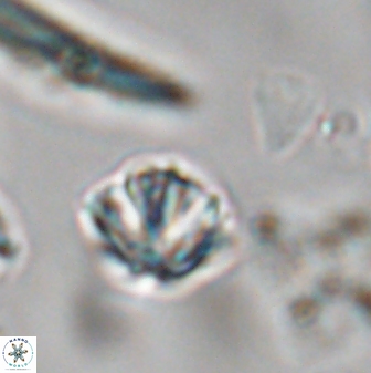 Discoaster artatus 28401