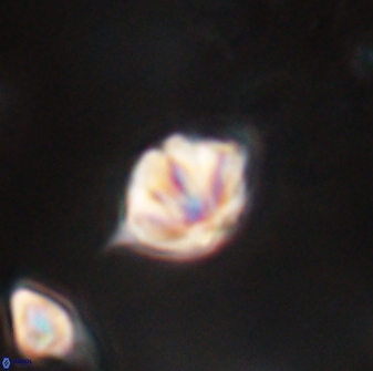 Discoaster artatus 28405