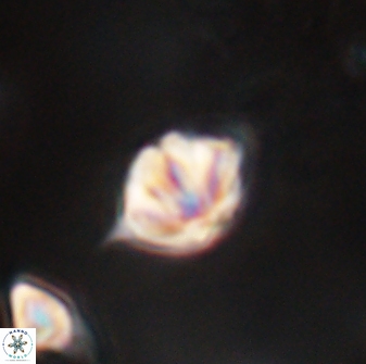 Discoaster artatus 28405
