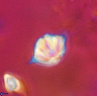 Discoaster artatus 28406