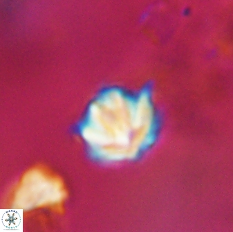 Discoaster artatus 28408