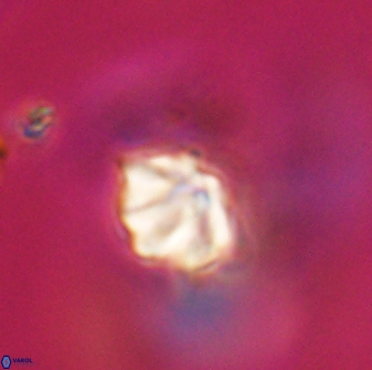 Discoaster artatus 28409