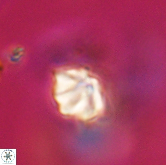 Discoaster artatus 28409