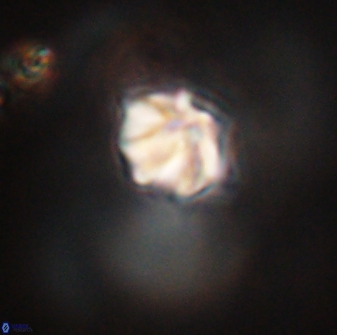 Discoaster artatus 28410