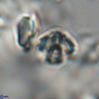 Discoaster artatus 28214