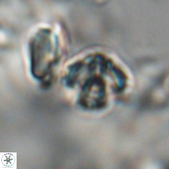 Discoaster artatus 28214