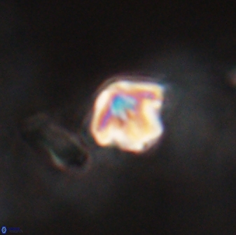 Discoaster artatus 28219