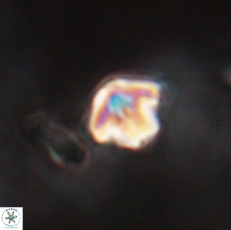 Discoaster artatus 28219