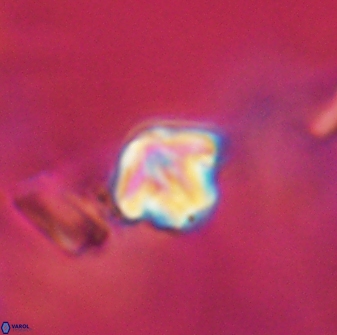 Discoaster artatus 28220