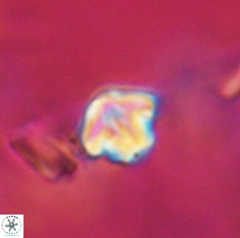 Discoaster artatus 28220