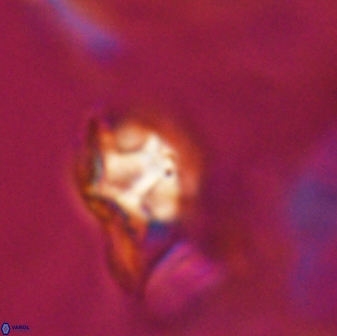 Discoaster artatus 28226