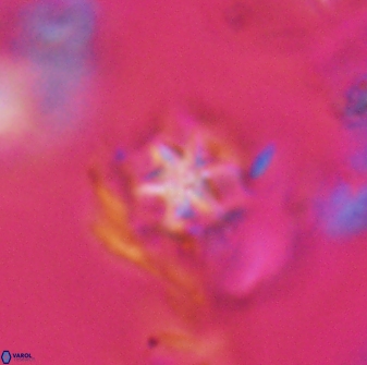 Discoaster artatus 28235