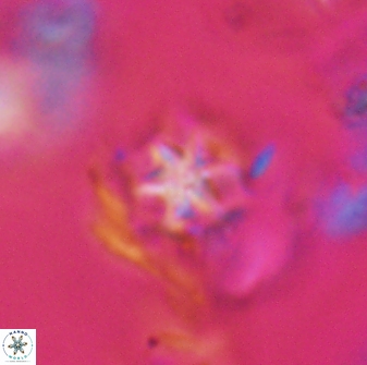 Discoaster artatus 28235