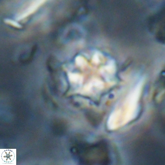 Discoaster artatus 28240