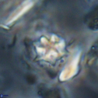 Discoaster artatus 28241