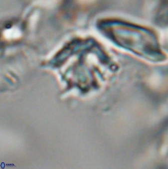 Discoaster artatus 28261