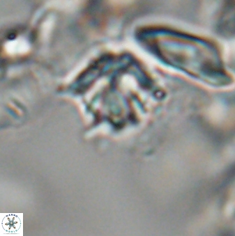 Discoaster artatus 28261