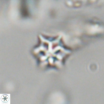 Discoaster artatus 28333