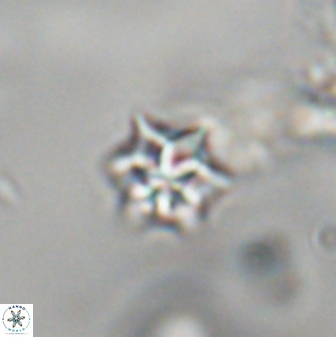 Discoaster artatus 28339