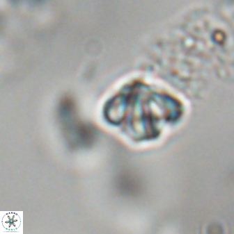 Discoaster artatus 28342