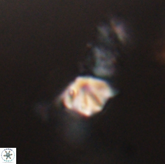 Discoaster artatus 28344