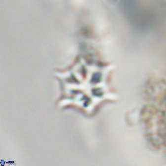 Discoaster artatus 28358