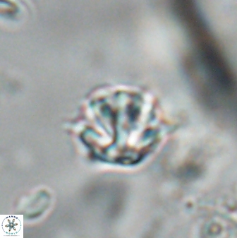 Discoaster artatus 28364
