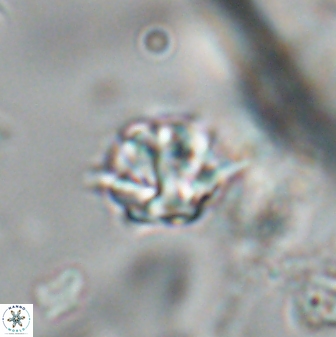 Discoaster artatus 28367