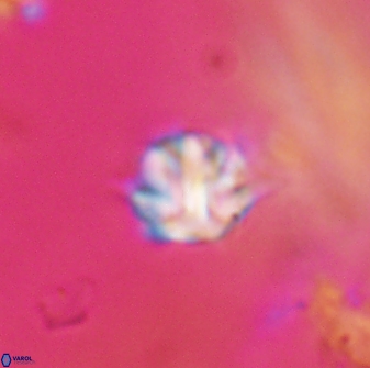 Discoaster artatus 28369