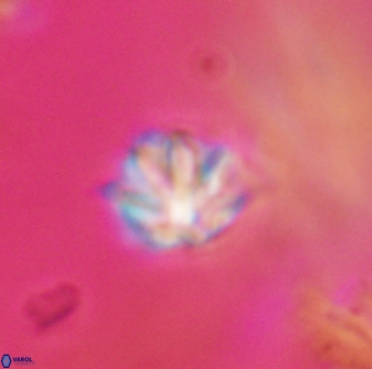 Discoaster artatus 28370