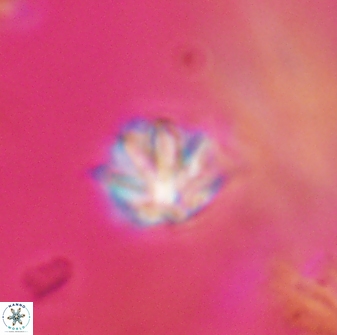 Discoaster artatus 28370