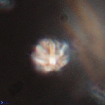 Discoaster artatus 28371