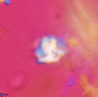 Discoaster artatus 28372