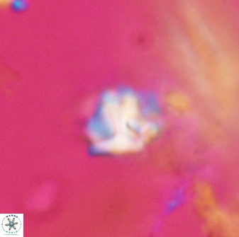 Discoaster artatus 28372