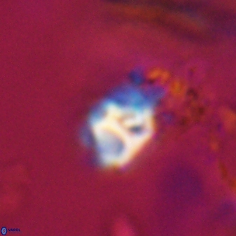 Discoaster artatus 28376