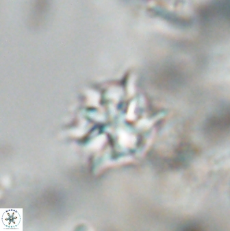 Discoaster artatus 28377